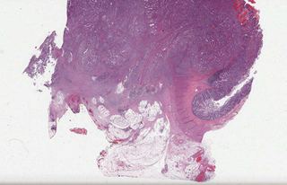 TCGA-CM-6675-01Z-00-DX1.4f2301e2-2894-484d-8a52-7be902a9861b.svs
