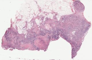 TCGA-CK-4947-01Z-00-DX1.b257d5fd-b97b-4987-b088-77f044ca7fe2.svs