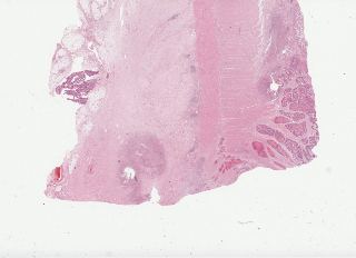 TCGA-D5-6533-01Z-00-DX1.a4b5096e-88cc-4797-b8d5-1a9cf1e74a55.svs