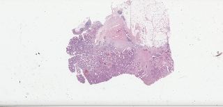 TCGA-D5-5537-01Z-00-DX1.14709d4c-eba0-48d0-87b8-5f34f74429d6.svs
