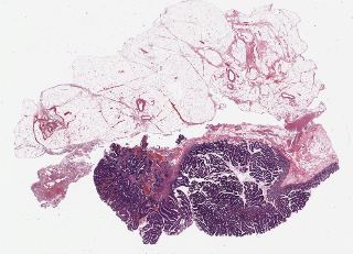 TCGA-4N-A93T-01Z-00-DX1.82E240B1-22C3-46E3-891F-0DCE35C43F8B.svs